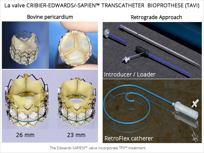 Remplacement de la valve aortique par cathéter (TAVI) - Centre de  Cardiologie Interventionnelle Belledonne