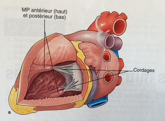 Plastie de la valve mitrale - Cardiologie et sport